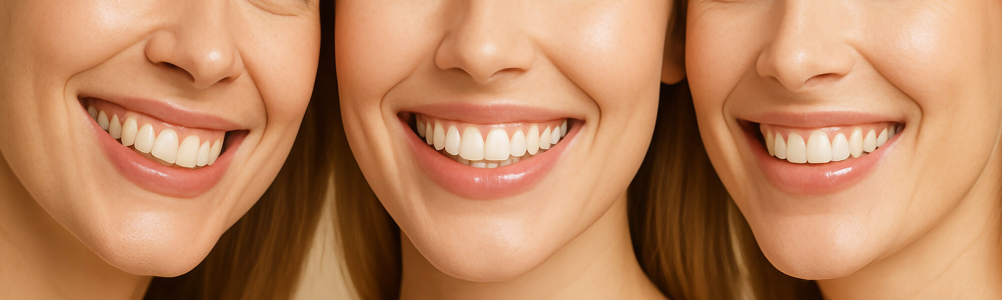 Dreiteiliges Bild mit Nahaufnahmen lächelnder Personen, jeweils mit sichtbaren Zähnen