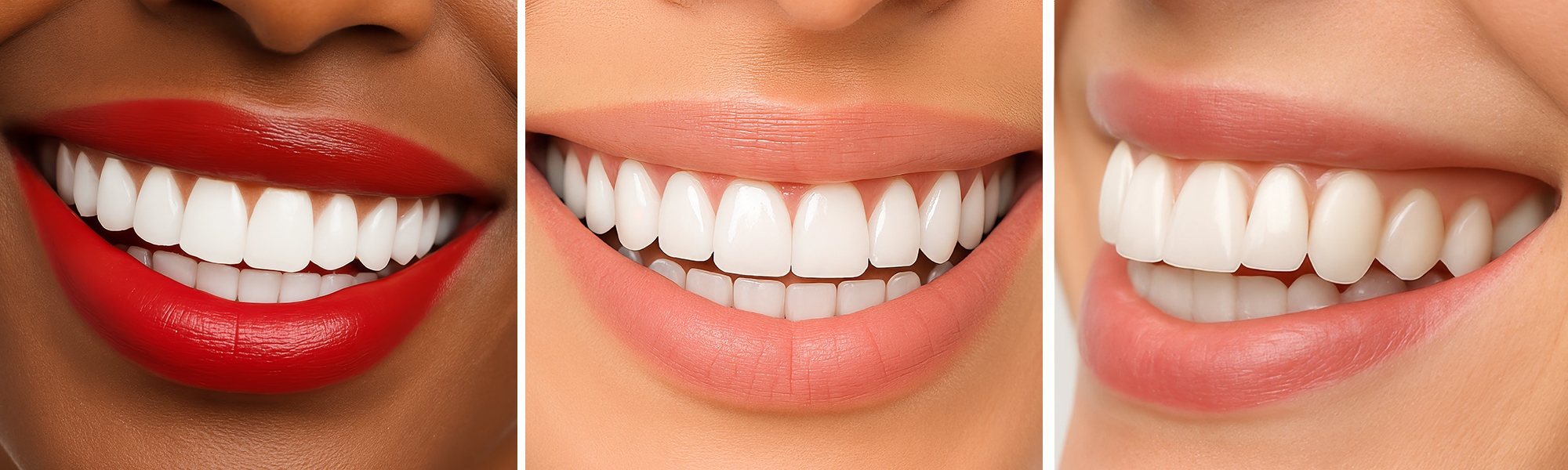 Drei Nahaufnahmen von strahlend weißen Zähnen mit gesunden Lippen und Zahnreihen, die verschiedene schöne Lächeln zeigen.